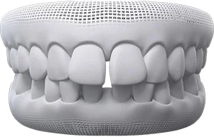 invisalign Teeth