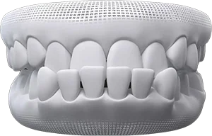 invisalign Teeth