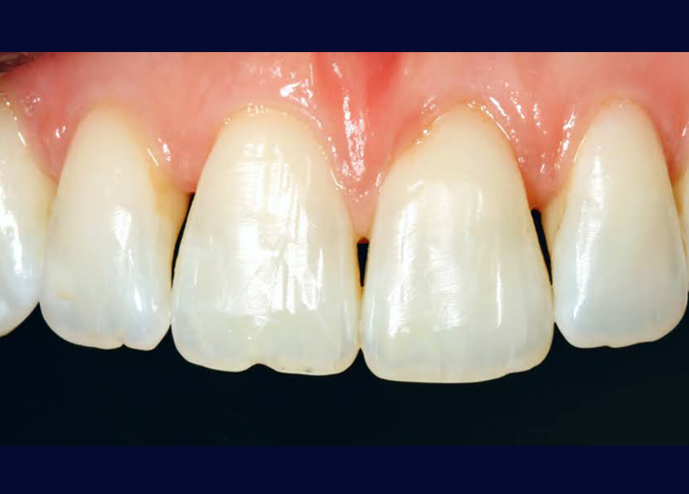 Before - West Street Dental